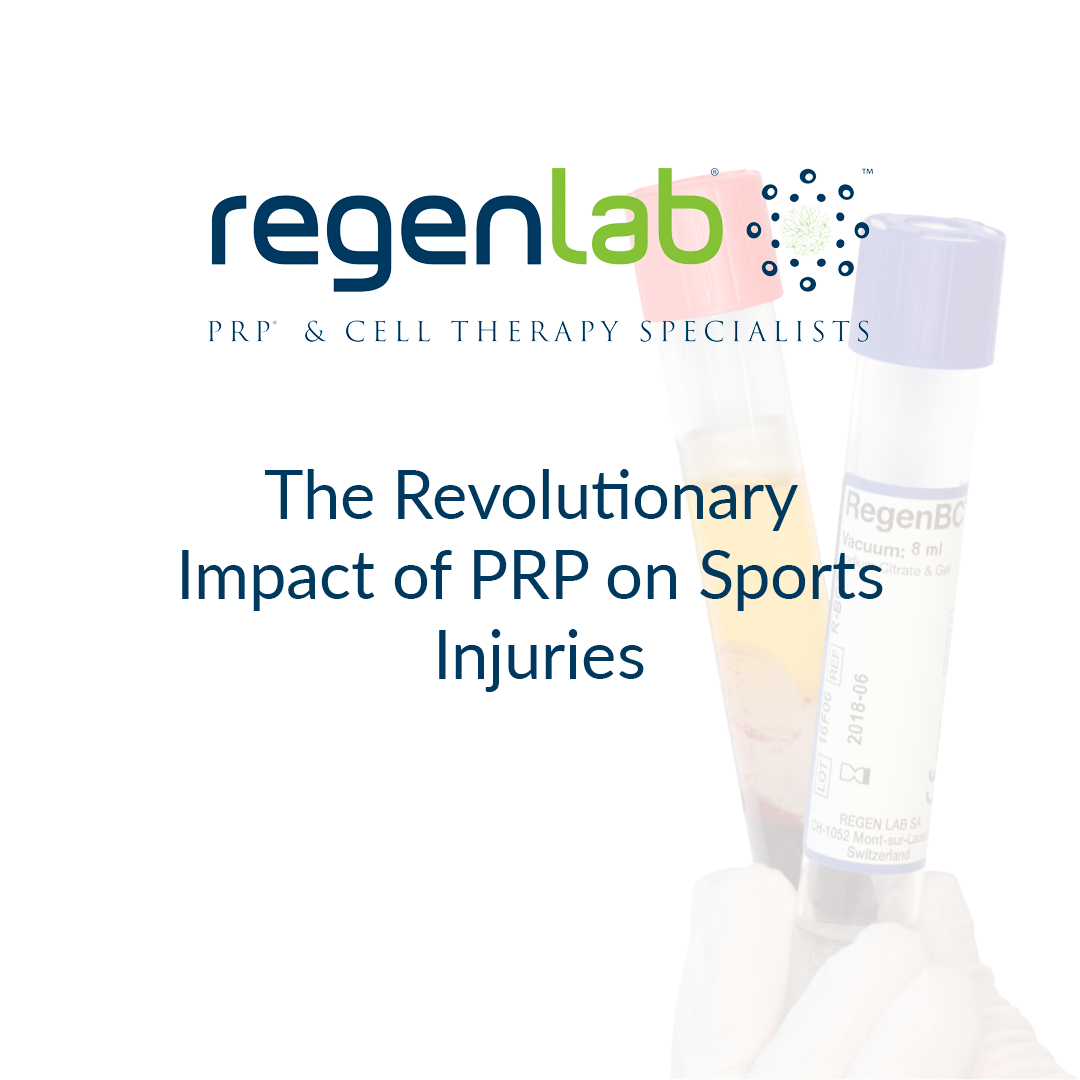 The Revolutionary Impact Of PRP On Sports Injuries RegenLab PRP