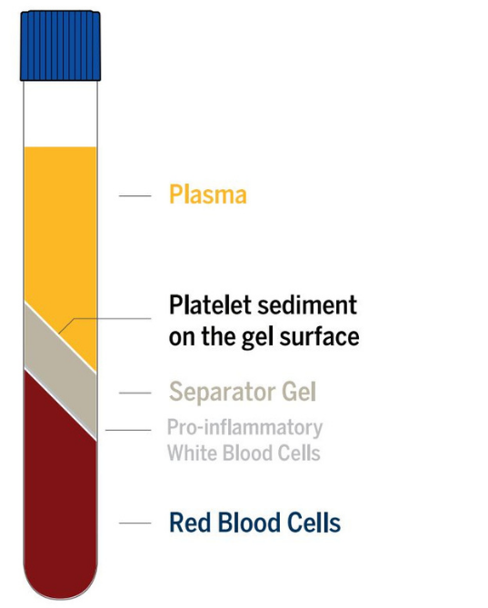 PRP what is it? RegenLab PRP Supplier PRP kits